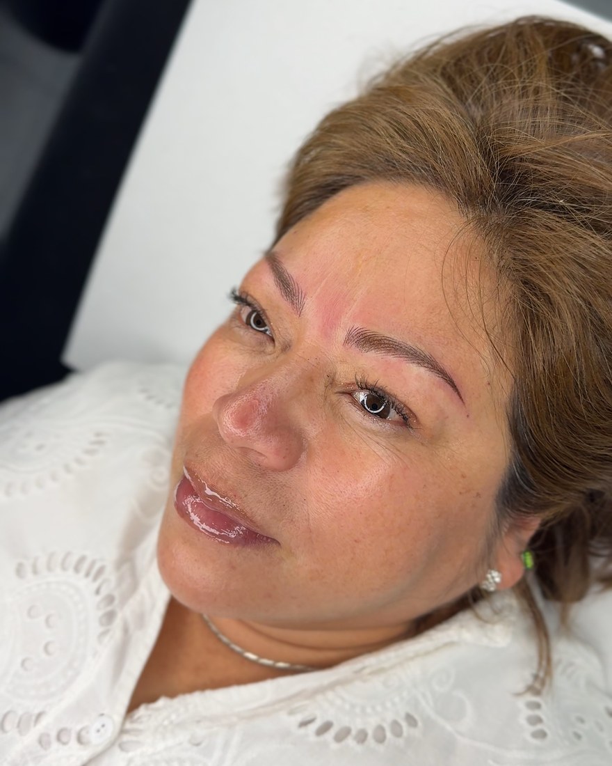 Brow result, mature client